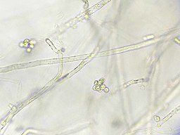 Photo of microscopic crayfish plague